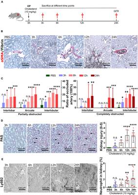 Neutrophil circadian rhythm is associated with different outcomes of acute kidney injury due to cholesterol crystal embolism